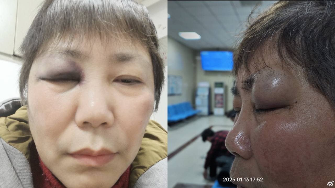 “法治示范市”的黑幕：宜昌女子遭强拆后又被限制人身自由，母亲病情堪忧